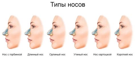 Виды носа