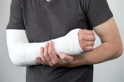 Как разработать руку после перелома в локтевом суставе