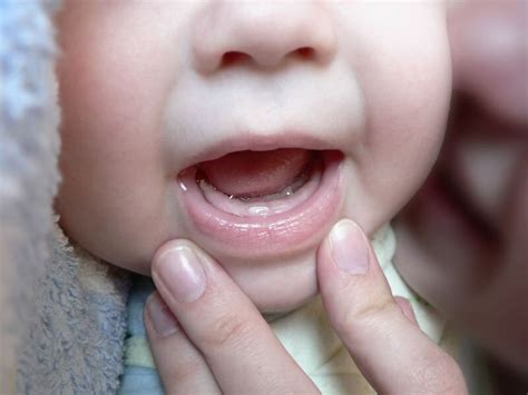 При прорезывании зубов у младенцев как облегчить