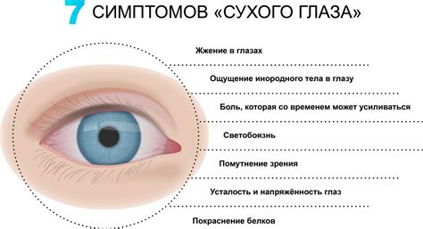 Что такое синдром сухого глаза